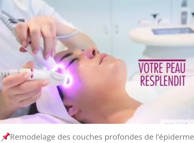 illustration Le Lifting Esthétique sans chirurgie le soin hautes technologie de rajeunissement: Le Duolift®