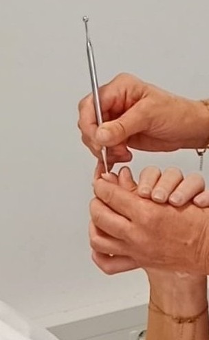 illustration Réflexologie Palmaire