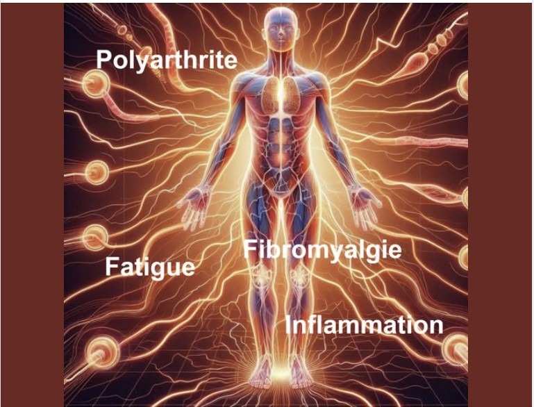 illustration Inflammation, Douleur, Fatigue.