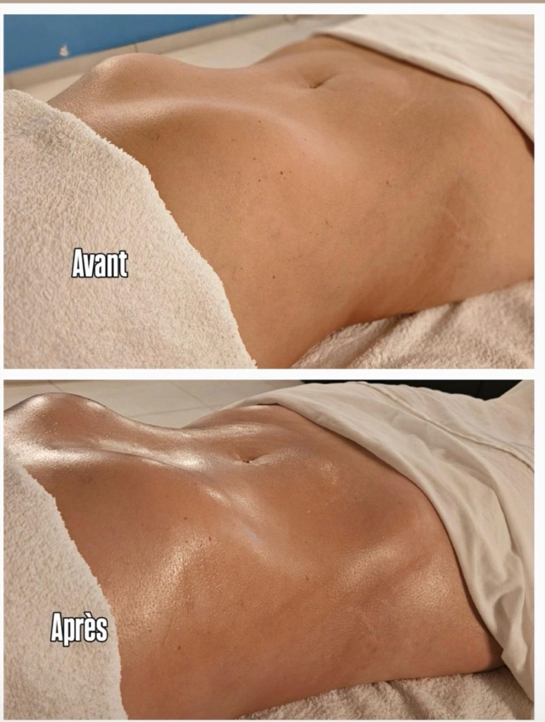 illustration Drenage Lynfathique Método Renata Franca et Drenage Facial et Massge Musculaire et Relaxation