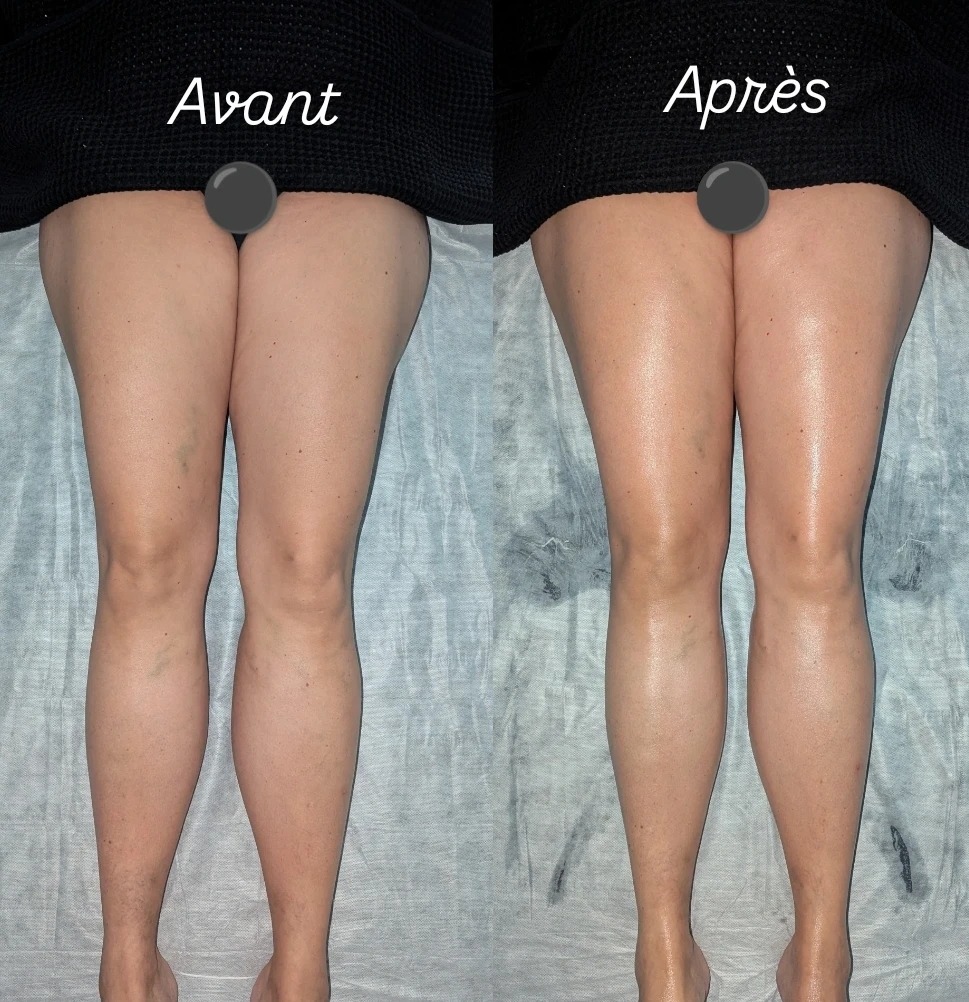 illustration Faites vous drainer pendant les vacances scolaires