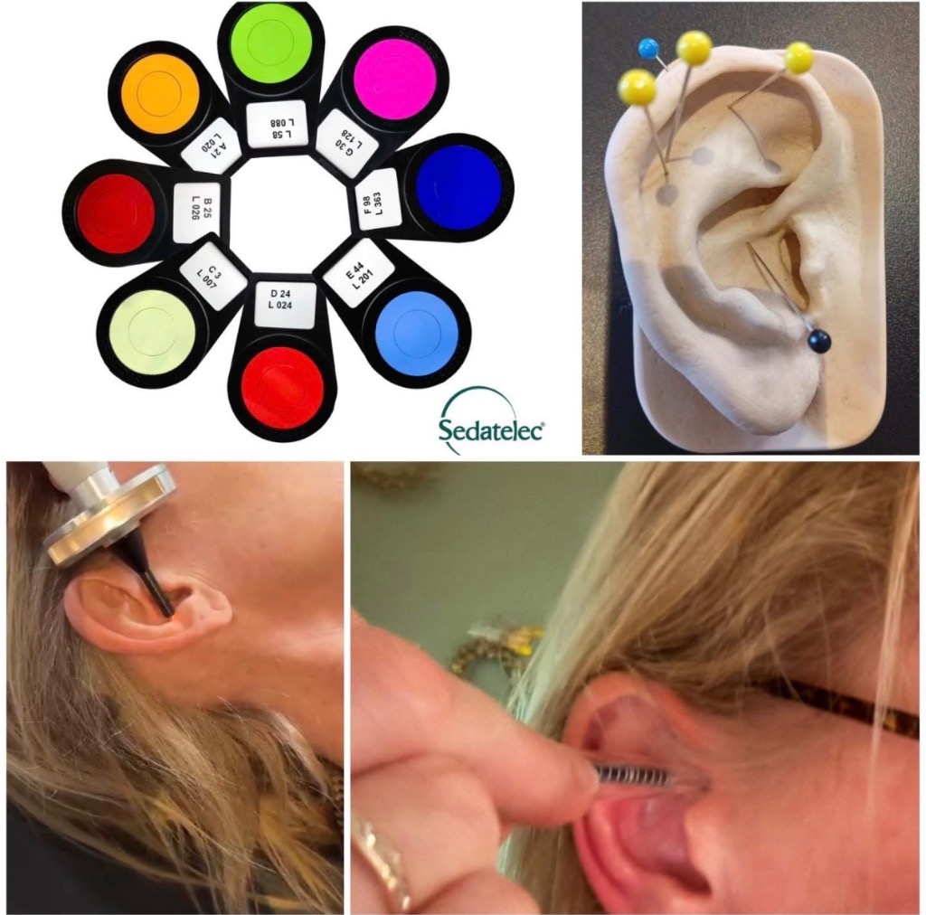 illustration Réflexologie auriculaire