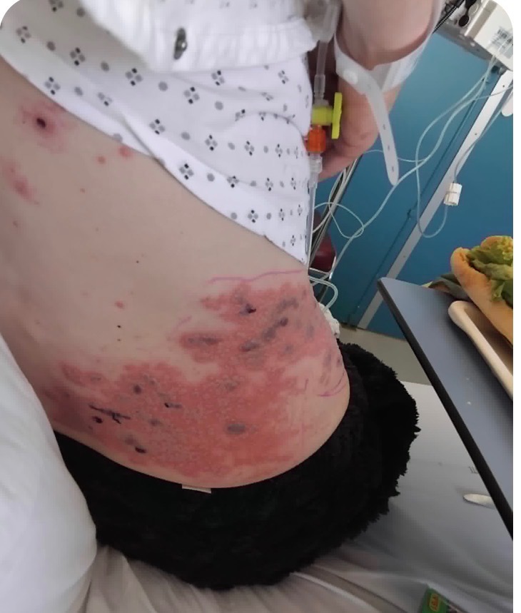 illustration 🌿 Peau et Émotions : Quand le Corps Exprime l'Invisible