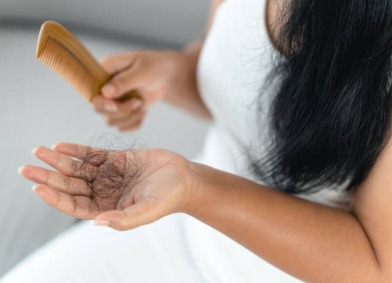 illustration Chute de cheveux — normale ou pas ?