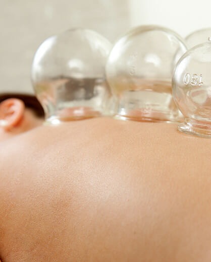 illustration Nouveauté : Séances de Hijama Sèche (Cupping Therapy) disponibles tous les week-ends à Massy