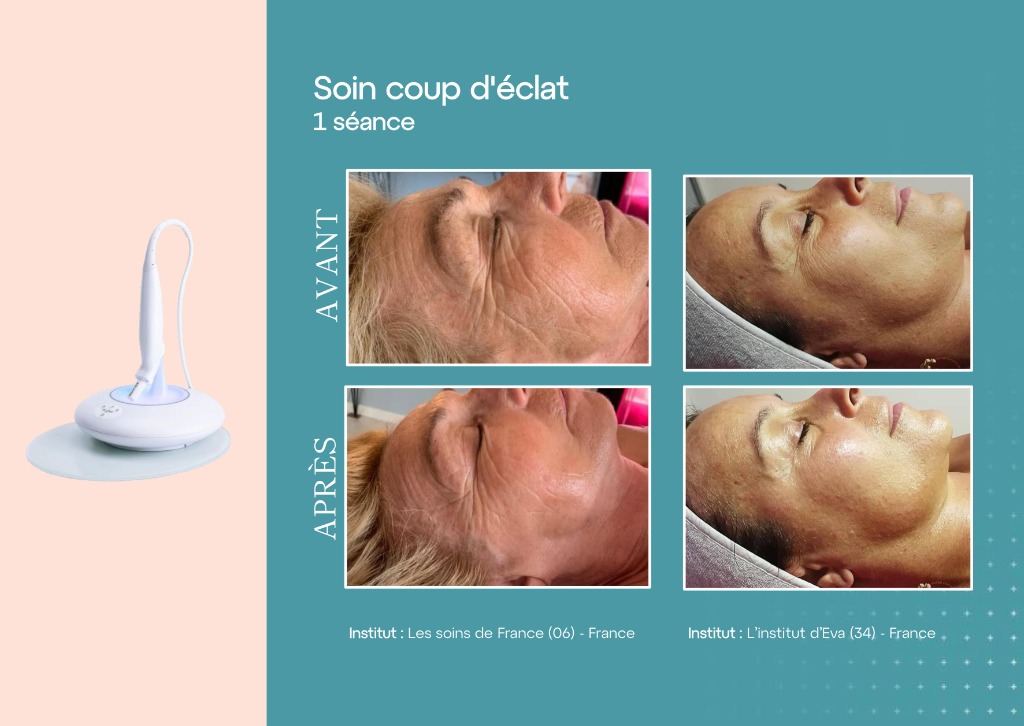 illustration Soins dermatologique visage corps  devis sur rdv