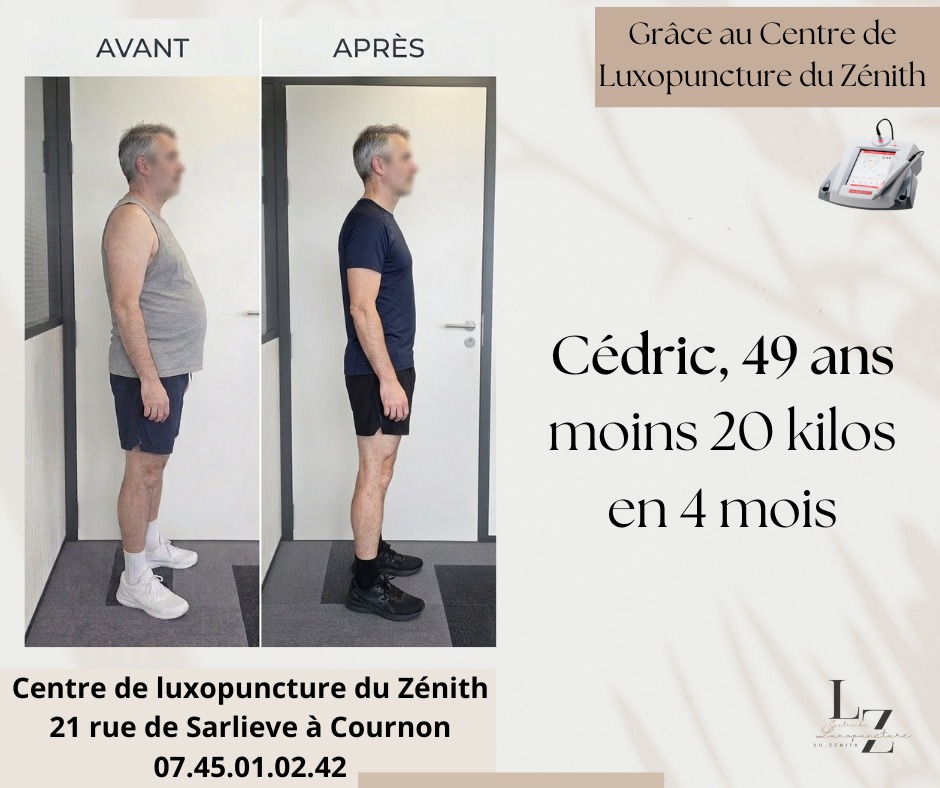illustration Avant/Après