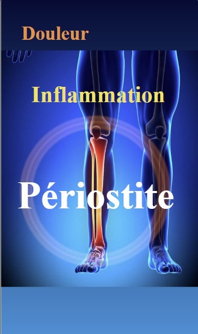illustration Périostite.