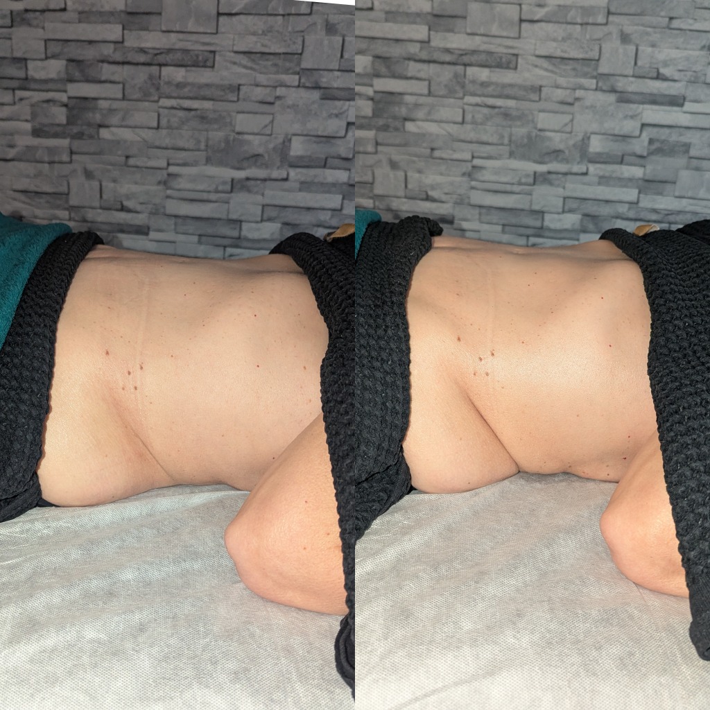 illustration Le drainage lymphatique manuel pour relancer la circulation