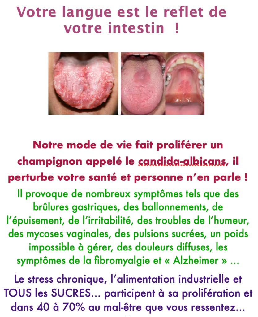 illustration Candida-albicans : la cause à de nombreux symptômes de mal-être