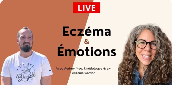 illustration Comment se libérer de l'eczéma ?