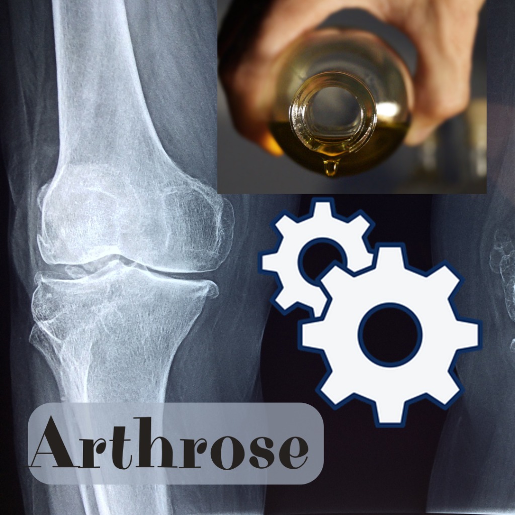 illustration Arthrose et thérapie naturelle : la chromatothérapie prouve son efficacité