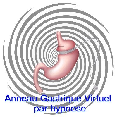 illustration pause anneau gastrique virtuel