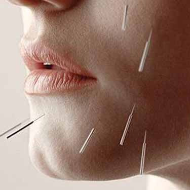 illustration Aculifting, raffermit la peau et réduit les signes du vieillissement !